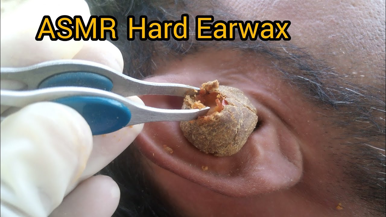 ASMR Ear cleaning for Deep Relaxation & Sleep | ASMR | Relax | Care |  Wax ----