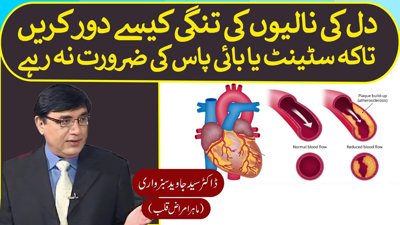 No Stents or Bypass. Just control those factors which cause narrowing of arteries.