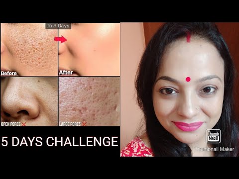 #Get glowing & Spotless SKIN At Home In Just 5 Days | #RICE POWDER
