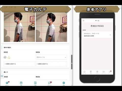 鍼灸つながるカルテ～患者アプリとのオンラインコミュニケーション編～