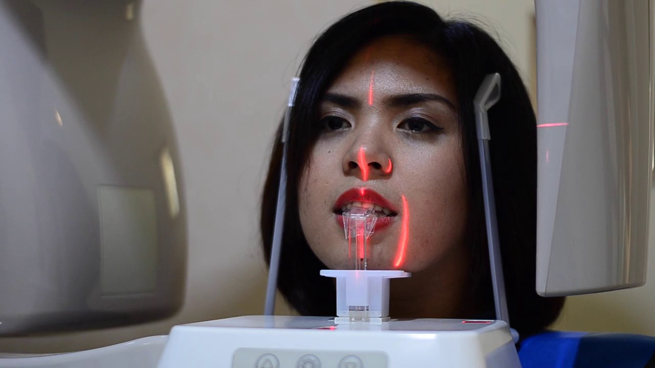 Digital X Ray by JP Romero Dental Group