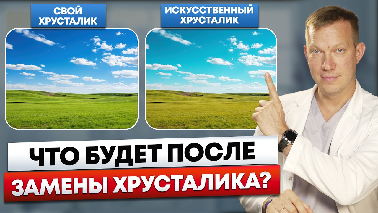 Последствия замены хрусталика, которые важно знать до операции