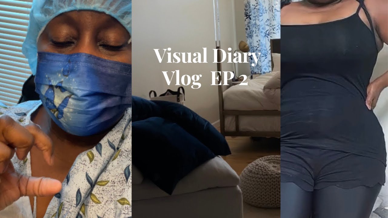 Laser Lipo Procedure This Was Painful Visual Diary Vlog EP 2 