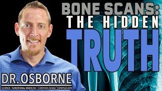 Celebrity The Hidden Truth About Bone Density - The Myth of Osteoporosis Net Worth
