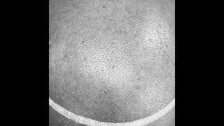 Scalp Micropigmentation SMP (Hair Tattoo)