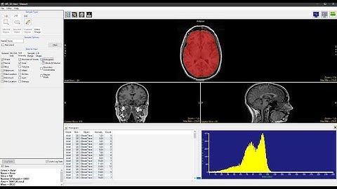 Analyze 15.0 - Measure: Sample 2D Closed Trace