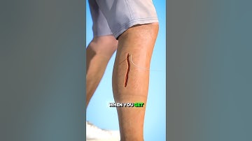 How Stitches Heal | Quick Breakdown