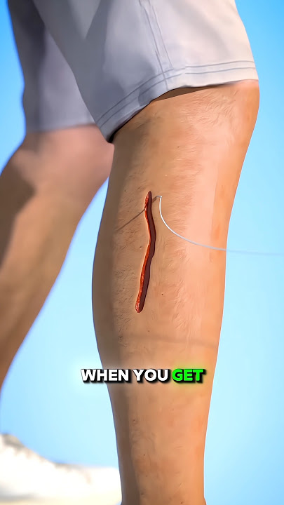 How Stitches Heal | Quick Breakdown