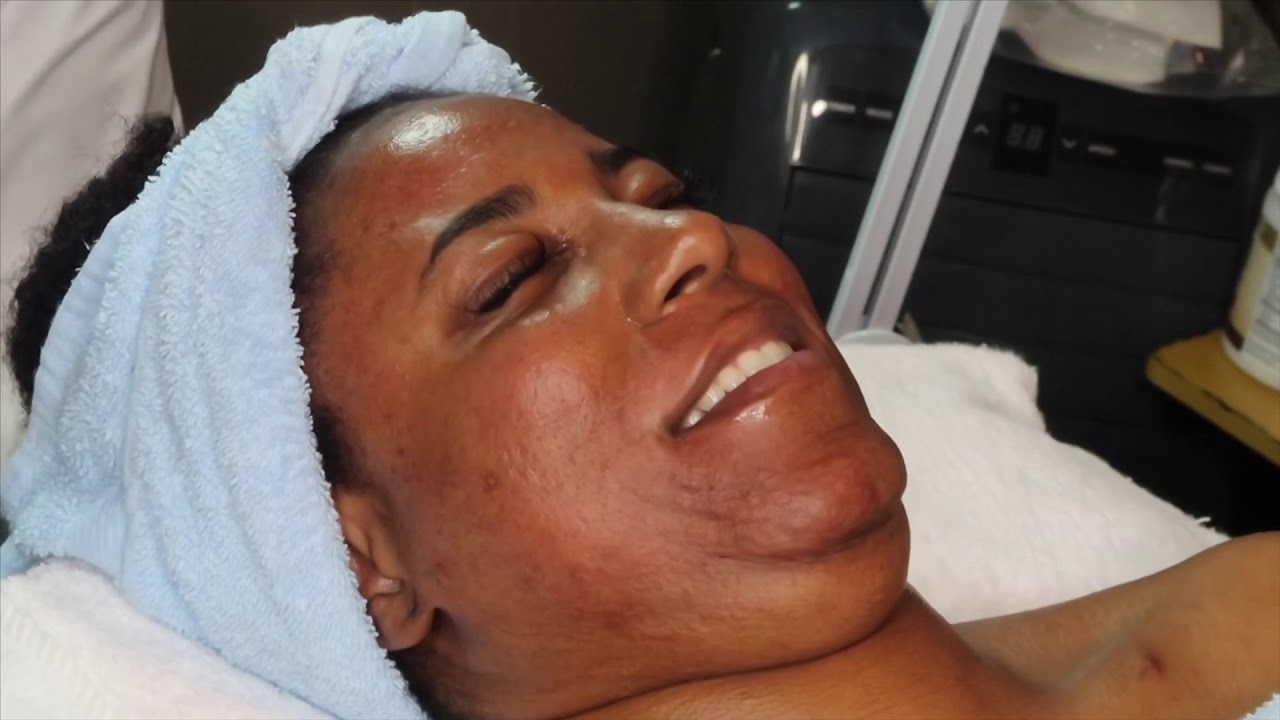 Dermaplaning & Chemical Peel Facial YouTube