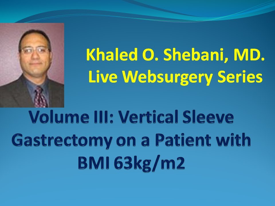 VERTICAL SLEEVE GASTRECTOMY (VSG); KHALED O. SHEBANI, MD. with