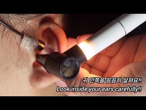 ASMR) Real Series_ 검이경 귀청소_ Otoscope Ear cleaning_ 剣耳鏡 耳掃除
