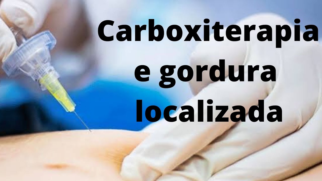 Carboxiterapia elimina gordura localizada - efeito da carbox na gordura ...
