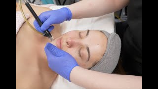 WATCH The Ultimate SKIN CARE TREATMENT: Dermalinfusion Facial
