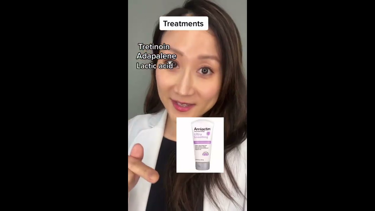 Treatments For Dark Armpits Knees Elbows And More SHORTS