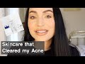 ZO Skin Health Cleared my Acne: How I Cleared my Acne | Sheridan Leatherberry