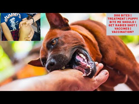Dog Bites | Treatment | Puppy Bite me Should I get Rabies Shot | Vaccines | Vaccination? Bhola