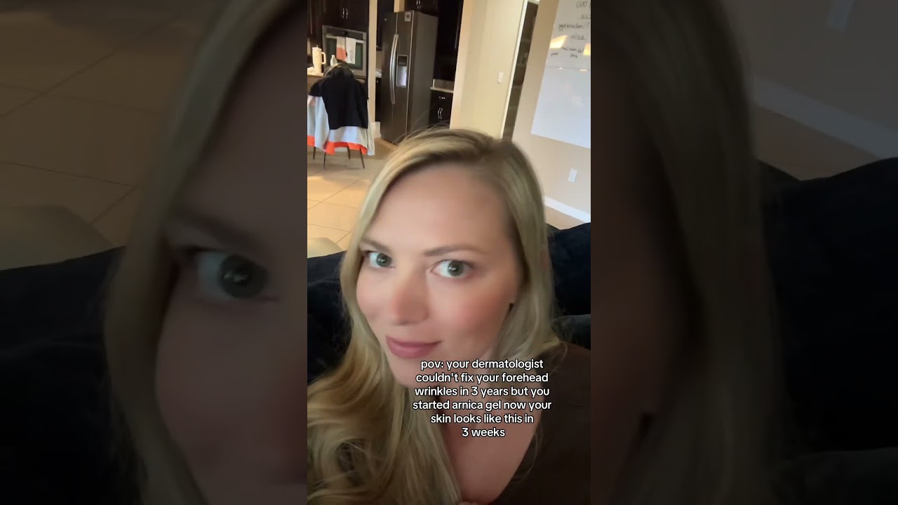 Arnica gel in 3 weeks