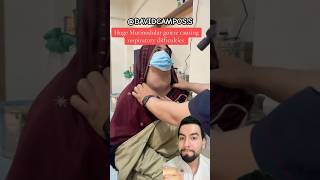 ENLARGED THYROID GLAND