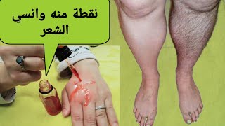 إزالة شعر البكيني والجسم كله نهائياً بديل الليزر للمناطق الحساسة هيخليكي صلعاء ملساء فلة شمعة منورة