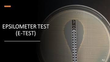 E-Test (Epsilometer Test)