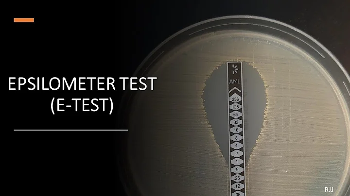 E-Test (Epsilometer Test)