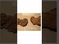 Real liver image