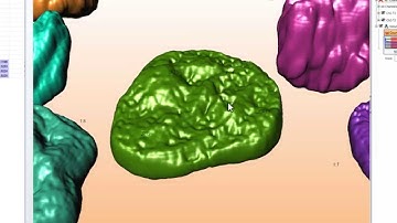 Manual Measurements [Image-Pro Premier 3D]