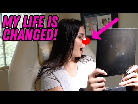 I GOT A NOSE JOB!!