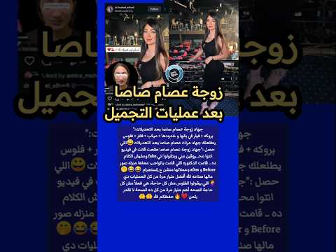 الدكتورة كشفت سرها جهاد زوجة عصام صاصا بعد التعديلات