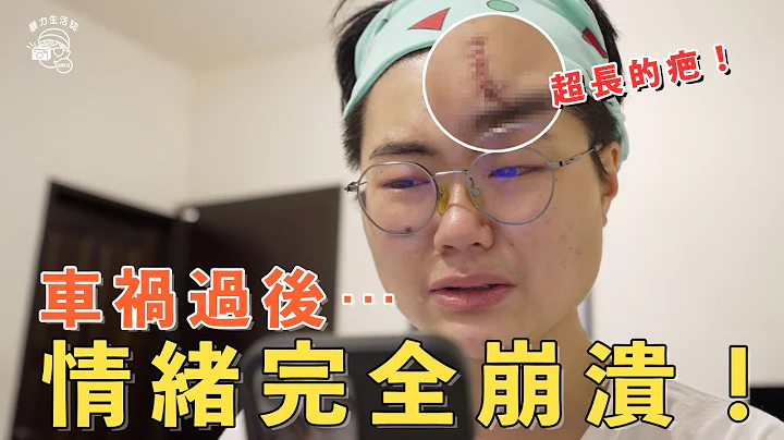 【崩溃💥】🛵车祸之后，看到脸上的疤痕，我破相了⋯情绪大崩溃🤯，心理创伤严重，一直失眠！7日康复记录Vlog【暴力生活VeeVlog 2022 EP2】 - 天天要闻