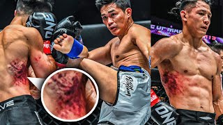 How Did Akimoto Survive Petchtanongs Body Shots? Fight Highlights