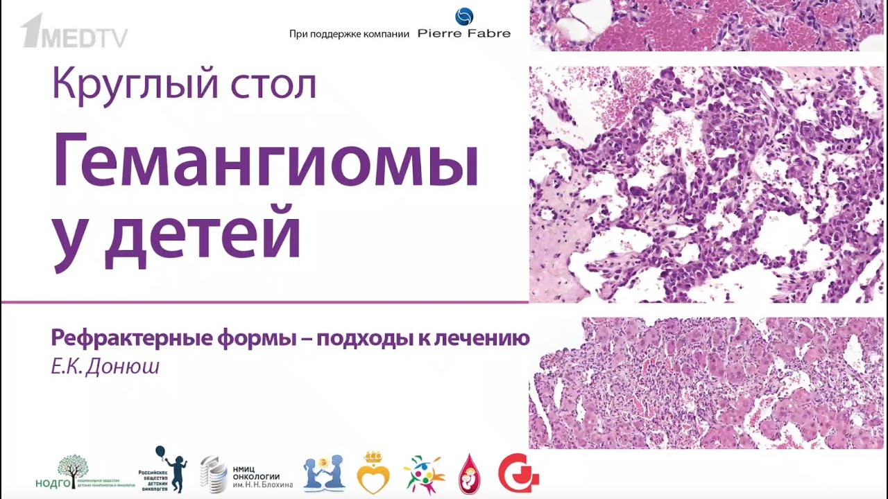 Донюш Е.К. "Рефрактерные формы - подходы к лечению"