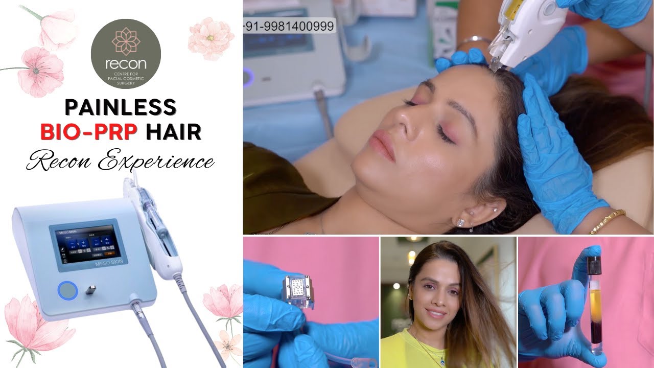 BIO PRP Treatment For Hair Loss 😍Teaser Video | Recon | Watch it Now!