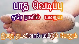 Home remedies for Cracked Feet/Heels in Tamil - பாத வெடிப்புகள் மறைய Foot Crack -Tamil Beauty Tips