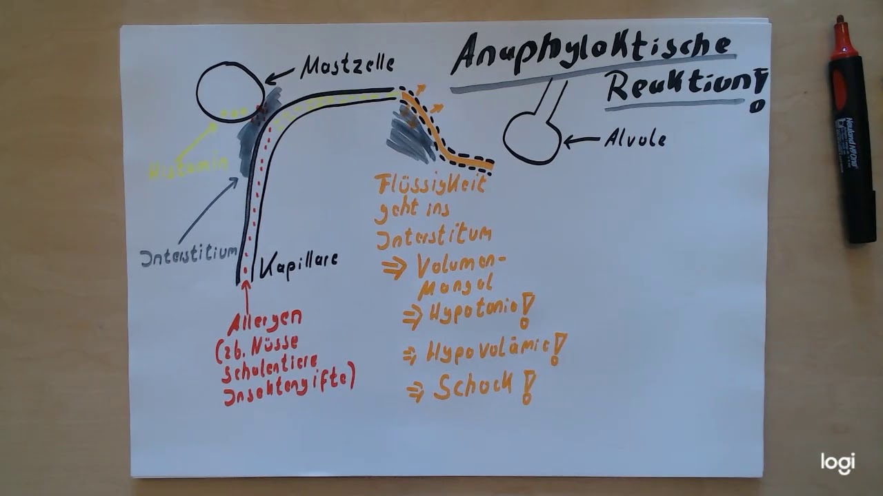 Fasttrack Folge 6  mit den Themen anaphylaktischer Schock und Empty, inkl. Anaphylaxie - Song