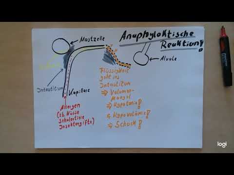 Video: Zeitleiste Einer Anaphylaktischen Reaktion