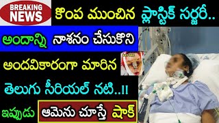 ప్లాస్టిక్ సర్జరీ ఫెయిల్ అవ్వడంతో అందాన్నికోల్పోయిన బుల్లితెర నటి! చూస్తేదడుచుకుంటారు Serial Actress