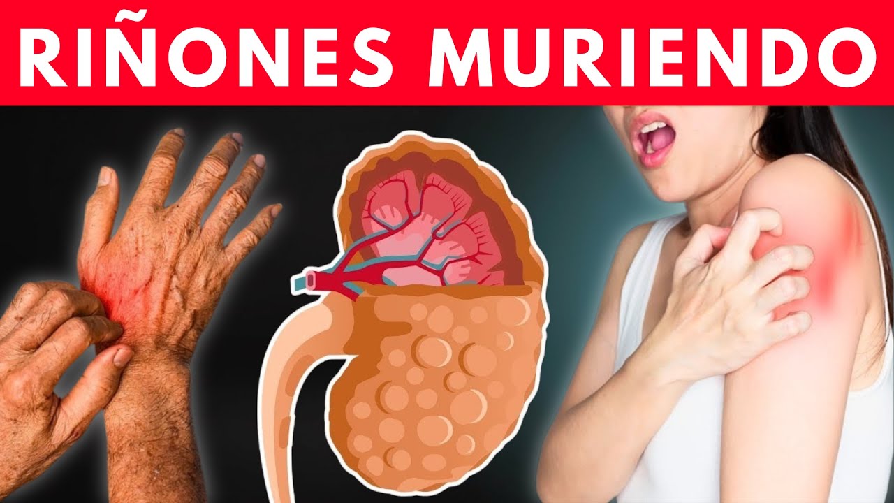 7 SEÑALES PELIGROSAS en tu CUERPO de que TUS RIÑONES están SUPLICANDO AYUDA