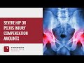 Severe Hip or Pelvis Injury Compensation Amounts