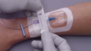 3M™ Tegaderm™ Antimicrobial I.V. Advanced Securement Dressing (9132) Application and Removal video