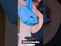 TERLEMEYE SON! Koltuk altı, ayak, avuç içi terlemelerini botoksla bitirin! 05076441334