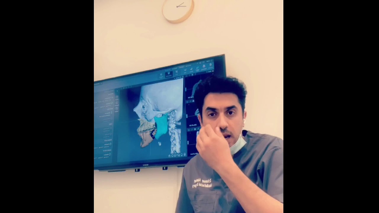 كيفية تحسين مستوى العين بعد كسور الوجنة وعظمة قاع العين؟ || د.ناصر العسيري