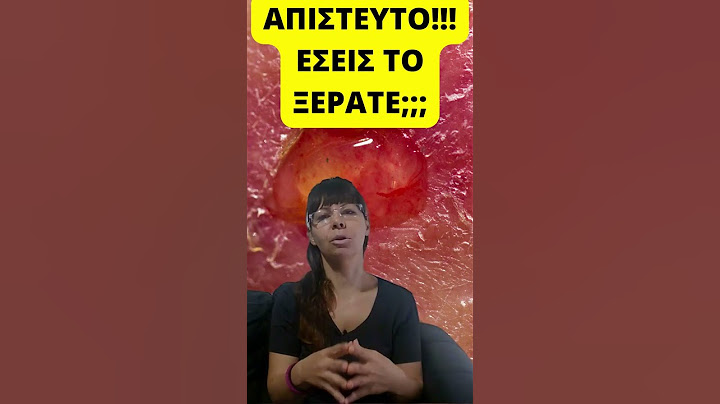 ΤΙ ΠΡΟΚΑΛΕΙ ΕΛΚΟΣ ΣΤΟ ΣΤΟΜΑΧΙ !!!#shorts