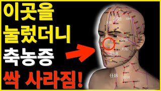 축농증! 이곳을 눌렀더니, 싹 사라짐~ 중의학 한의학 혈자리 침치료 혈자리 마사지, 상영향, 지압 혈자리