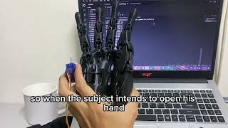 BEC-08 [EEG-Controlled Prosthetic Hand Using OpenBCI for Individuals with Hand Paralysis]