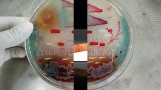 Agar art with living microbes preparation tips and its importance