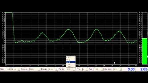 Basic EMG Tour of UI