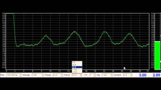Basic EMG Tour of UI
