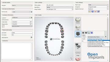 How to use the Open Implants Library in 3shape