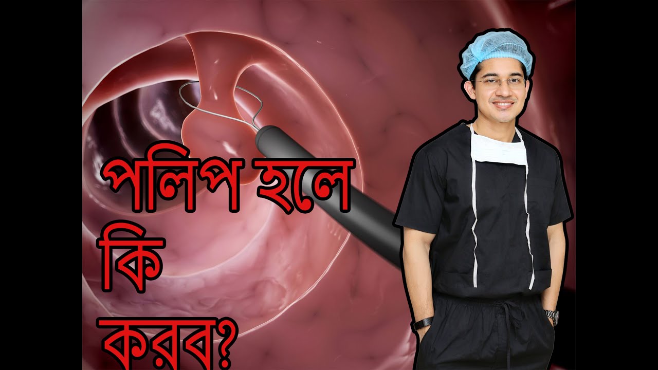 পলিপ হলে কি করব? - YouTube